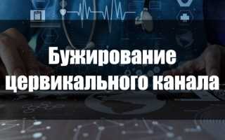Как проводится и для чего назначается бужирование цервикального канала